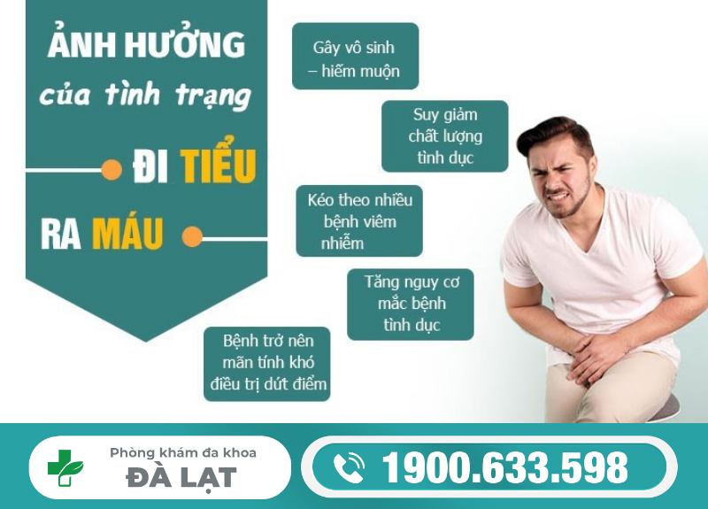 Hình ảnh minh họa